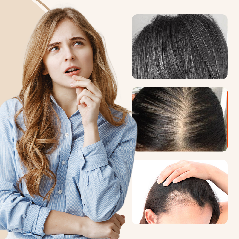 đ„Soldesđ„Frange partielle naturelle Ă clipser